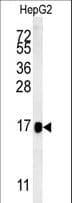 Polyclonal Rabbit anti-Human BLOC1S2 Antibody (aa14-40, IHC, WB)