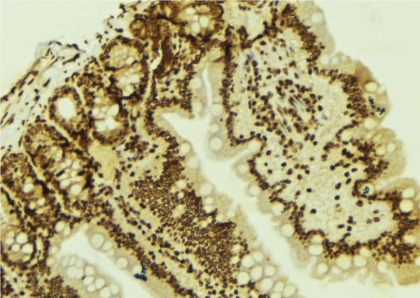 LEF1 Antibody
