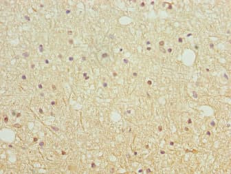 SH3GL2 Antibody