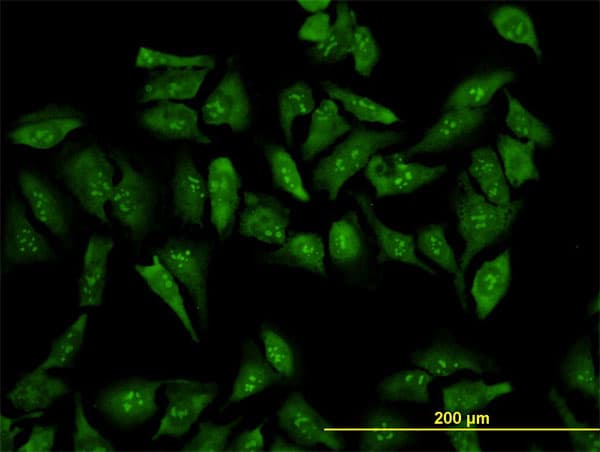 RPL19 / Ribosomal Protein L19 Antibody (clone 3H4)