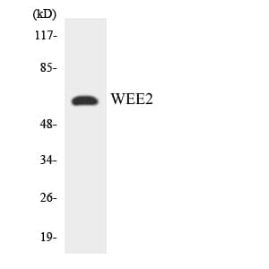 Polyclonal Rabbit anti-Human WEE1B / WEE2 Antibody (aa138-187, WB)