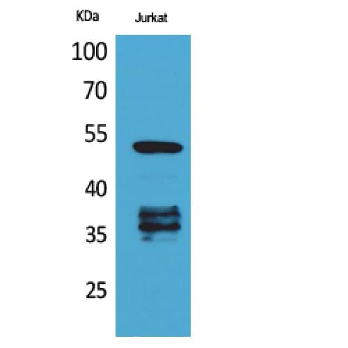 Polyclonal Rabbit anti-Human TP53 / p53 Antibody (acetylation site of K370., WB)