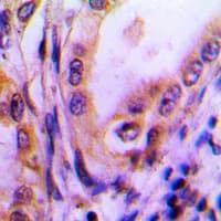 Polyclonal Rabbit anti-Human THBS4 / Thrombospondin 4 Antibody (Internal, IHC, WB)