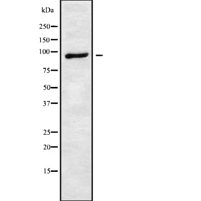 ATXN7 / SCA7 / Ataxin-7 Antibody