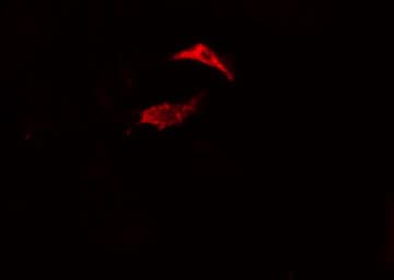 RAP2B Antibody