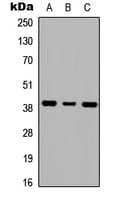 GALR1 / Galanin Receptor 1 Antibody (Internal)
