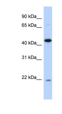 NOB1 / NOB1P Antibody (aa35-84)