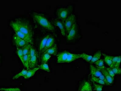 Polyclonal Rabbit anti-Human PRKACB Antibody (IHC, IF, WB)