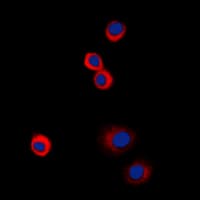 IGF1R / IGF1 Receptor Antibody (phospho-Tyr1161)