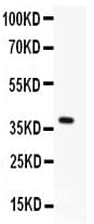 MBD2 Antibody (aa159-411)