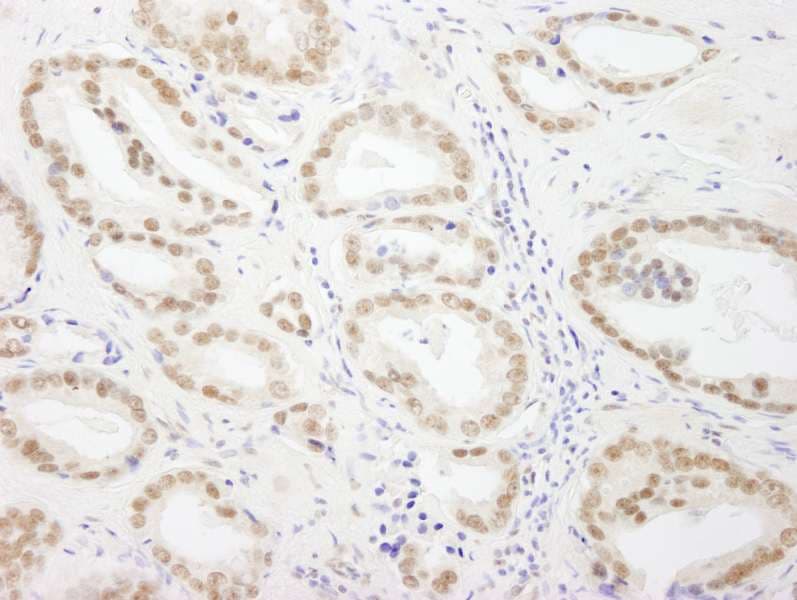 Polyclonal Rabbit anti-Human GTF3C5 Antibody (aa469-519, IHC)
