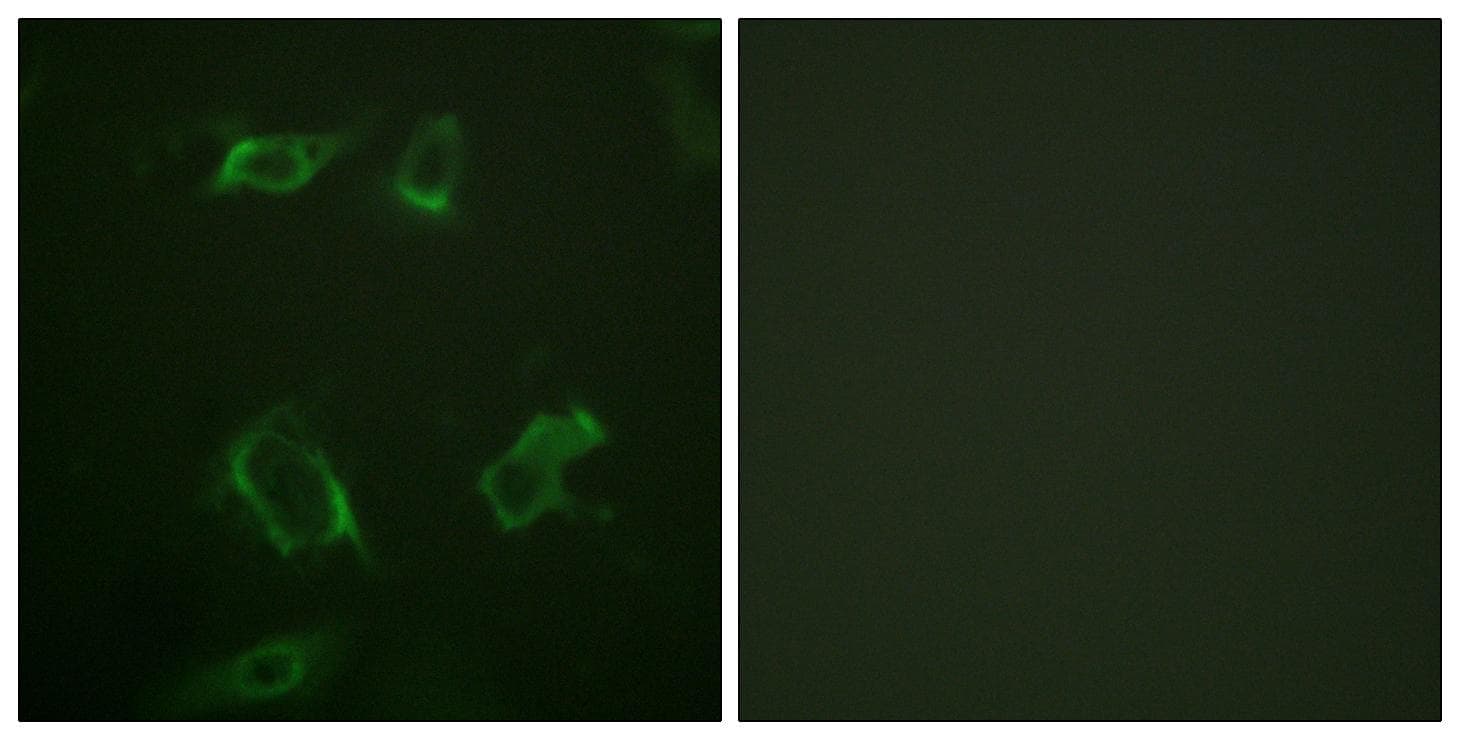 PLD1 / Phospholipase D1 Antibody (phospho-Ser561)
