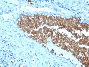 SPTA1 / Alpha Spectrin Antibody (clone SPTA1/1832)