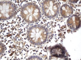 Monoclonal Mouse anti-Human ARL2BP / BART Antibody (clone OTI1F8, IHC, WB)