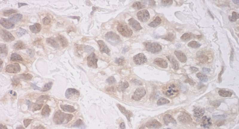 RECQ5 / RECQL5 Antibody (aa1-50)
