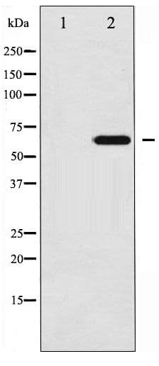 EZR / Ezrin Antibody (phospho-Tyr146)