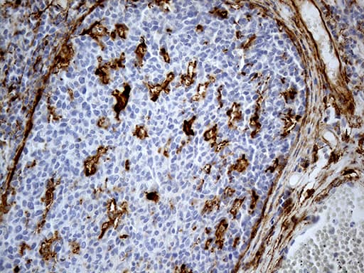 Monoclonal Mouse anti-Human MRC2 / Endo180 Antibody (clone OTI9G4, IHC, WB)