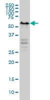 IHC-plus™ Monoclonal Mouse anti-Human YY1 Antibody (clone 4D2, IHC, IF, WB)