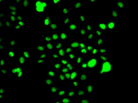 Polyclonal Rabbit anti-Human CEBPG / CEBP Gamma Antibody (IHC, IF, WB)