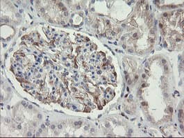 PHKG2 Antibody (aa1-216, clone OTI1F9)