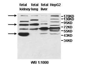 ALS2 / Alsin Antibody (aa177-414)