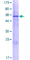 Human RIMKLB Protein (Recombinant GST)