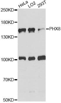 Polyclonal Rabbit anti-Human DHX8 Antibody (WB)