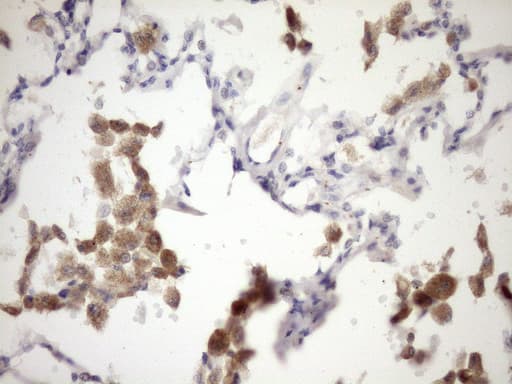 Monoclonal Mouse anti-Human IL12A / p35 Antibody (clone OTI2A8, Carrier-free, aa57-253, IHC, WB)