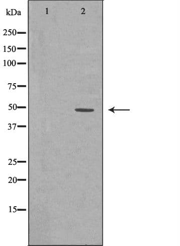 Polyclonal Rabbit anti-Human RAD52 Antibody (IHC, IF, WB)