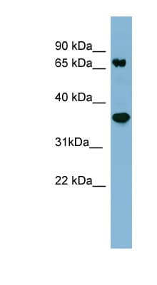 Polyclonal Rabbit anti-Human PPP2R1B Antibody (aa35-84, WB)