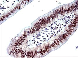 PMS2 Antibody (clone OTI2G5)
