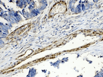 Polyclonal Rabbit anti-Human PPP1R14A / CPI-17 Antibody (IHC, WB)