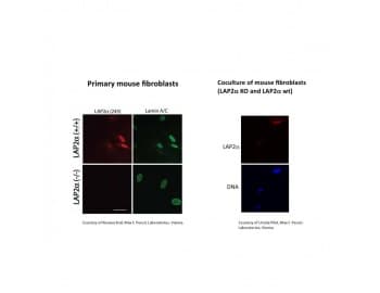 Polyclonal Rabbit anti-Human TMPO / TP / Thymopoietin Antibody (C-Terminus, IF, WB)