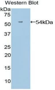 ANGPTL3 Antibody (aa17-460)