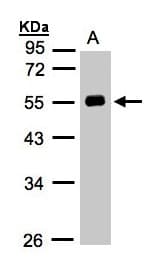 AGT / Angiotensinogen Antibody (aa1-476)