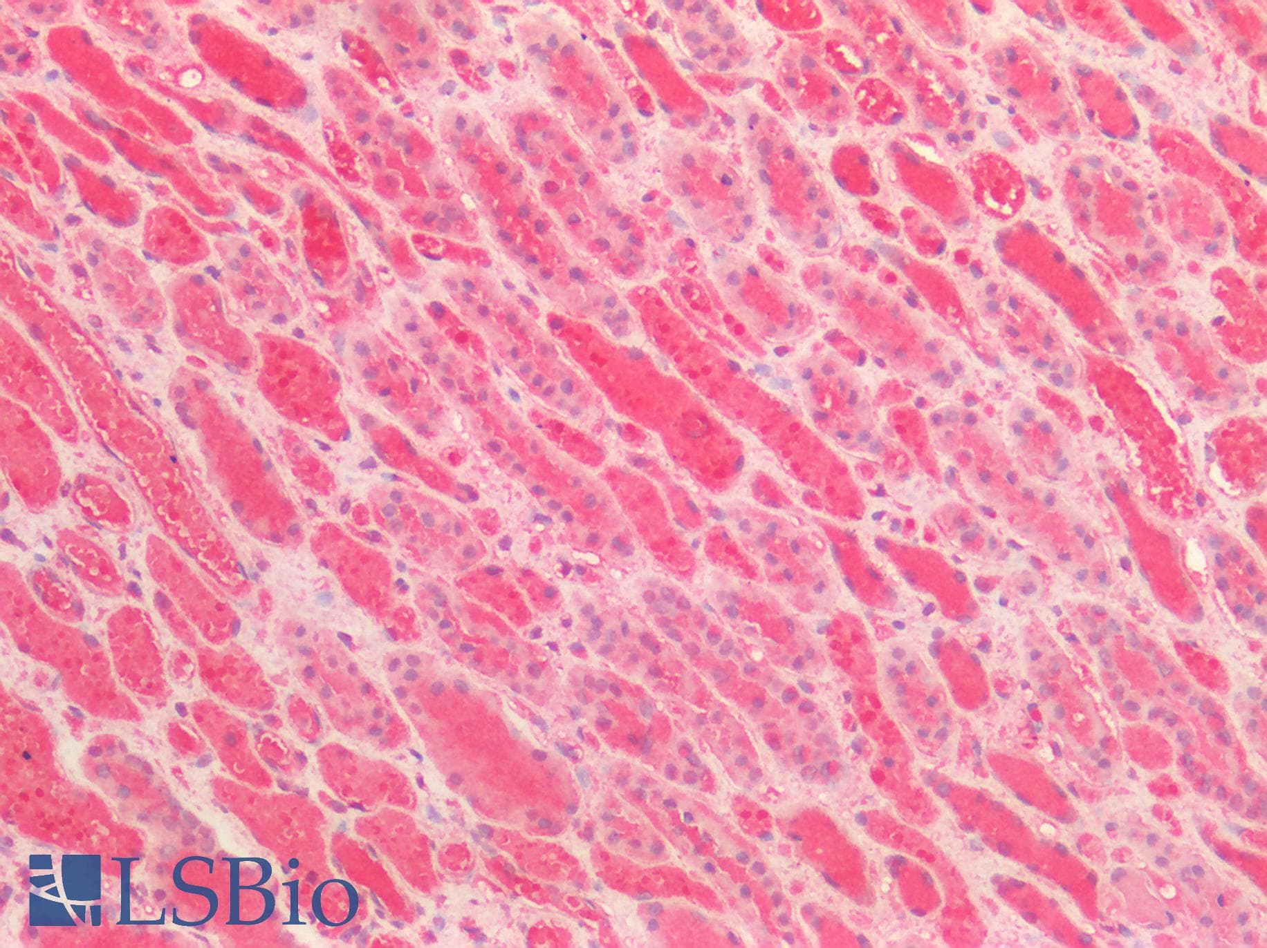 IHC-plus™ Polyclonal Rabbit anti-Human ATG16L1 / ATG16L Antibody (IHC)