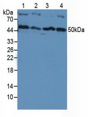 PIK3CB / PI3K Beta Antibody (aa321-507, APC)