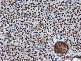 TRIM38 Antibody (clone OTI113D3)