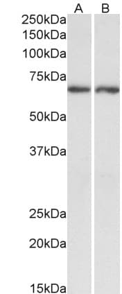 Polyclonal Goat anti-Human ACHE / Acetylcholinesterase Antibody (aa601-614, IF, WB)