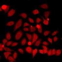 SMC1A / SMC1 Antibody