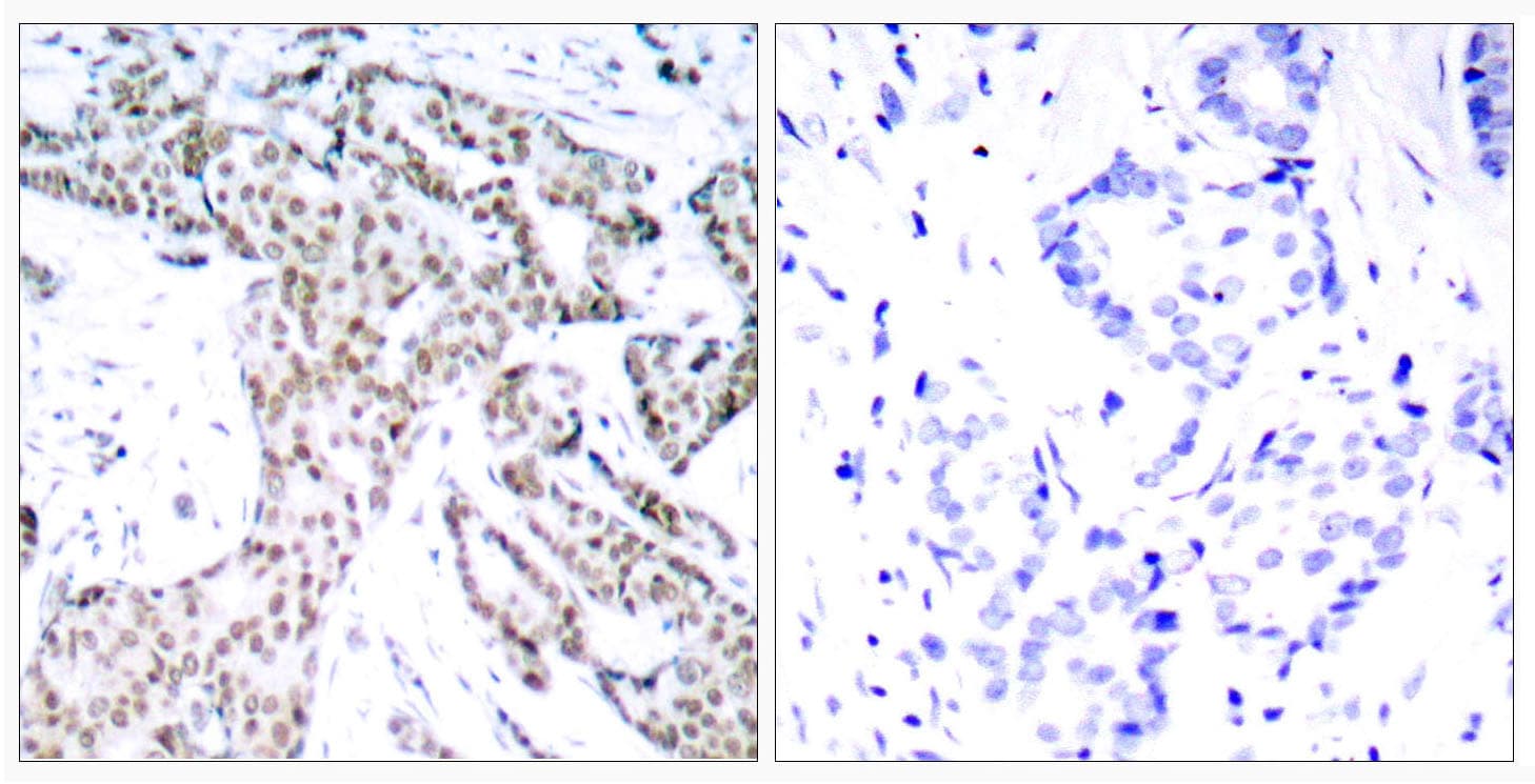 STAT3 Antibody (phospho-Ser727)