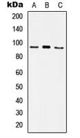 ITGA5/Integrin Alpha 5/CD49e Antibody (N-Terminus)