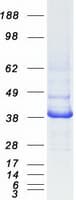 Human IDH3A Protein (Recombinant Myc-DDK (Flag))