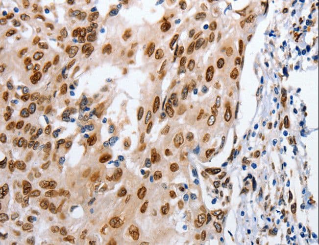 Polyclonal Rabbit anti-Human MUTYH / MYH Antibody (IHC, WB)