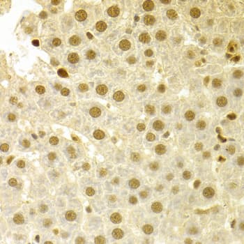 SFN / Stratifin / 14-3-3 Sigma Antibody