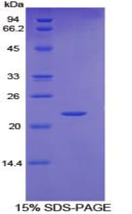 Human IL6ST / CD130 / gp130 Protein (Recombinant His)