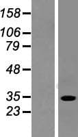 SULT1A2 / Sulfotransferase 1A2 Protein (Over-Expression Lysate Myc-DDK (Flag))