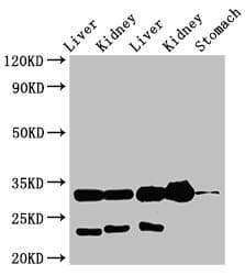 IHC-plus™ Polyclonal Rabbit anti-Human Tpsb2 / Tryptase Beta 2 (Mouse Antibody (IHC)