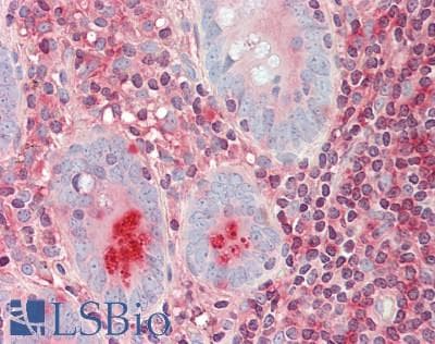 S100G / CABP9K Antibody