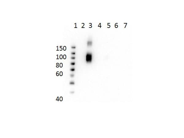 HBD / Hemoglobin Delta Antibody (N-Terminus, clone 21G1.F1.B9.G9.D11)